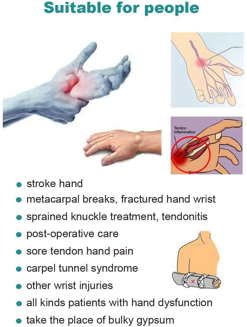 [Australia] - Soft Resting Hand Splint Night Wrist Splint Support Immobilizer Finger Wrist Fracture Fixation Scaffold for Stroke Hand Pain Tendinitis Sprain Fracture Arthritis Dislocation (Large, Left) Large for Left hand 