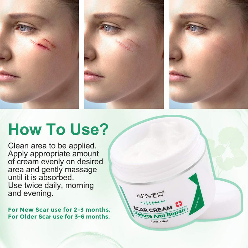 [Australia] - Aliver Scar Removal Cream for Old & New Scars, Stretch Mark Remover for Men & Women, Acne Scar Removal on Face or Body, Scar Treatment for Cuts,Surgery, Burn, Cut, Keloid, C-Section 