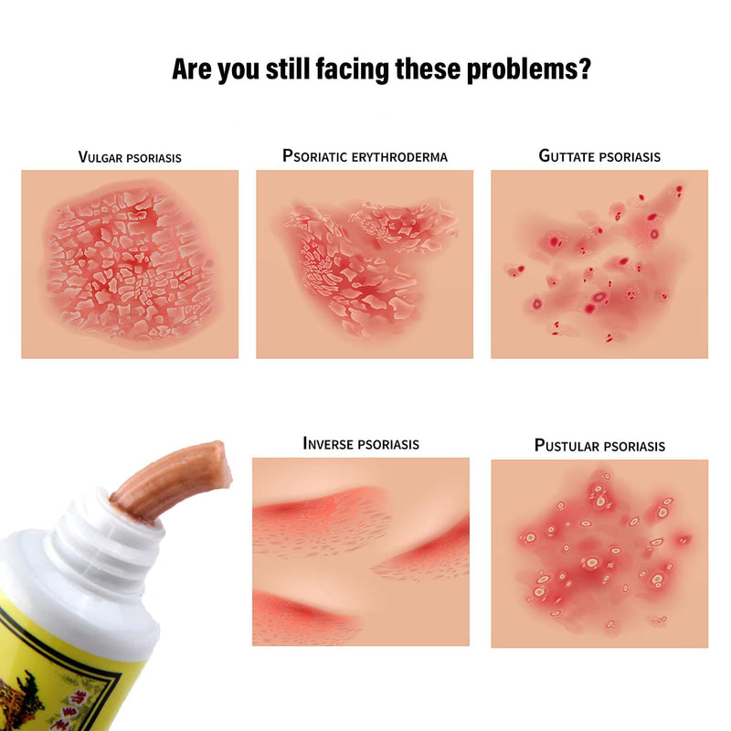 [Australia] - 5Pcs Chinese Herbal Eczema, Psoriasis Creams Dermatitis and Eczema Pruritus Psoriasis CEZUBEM Ointment New 