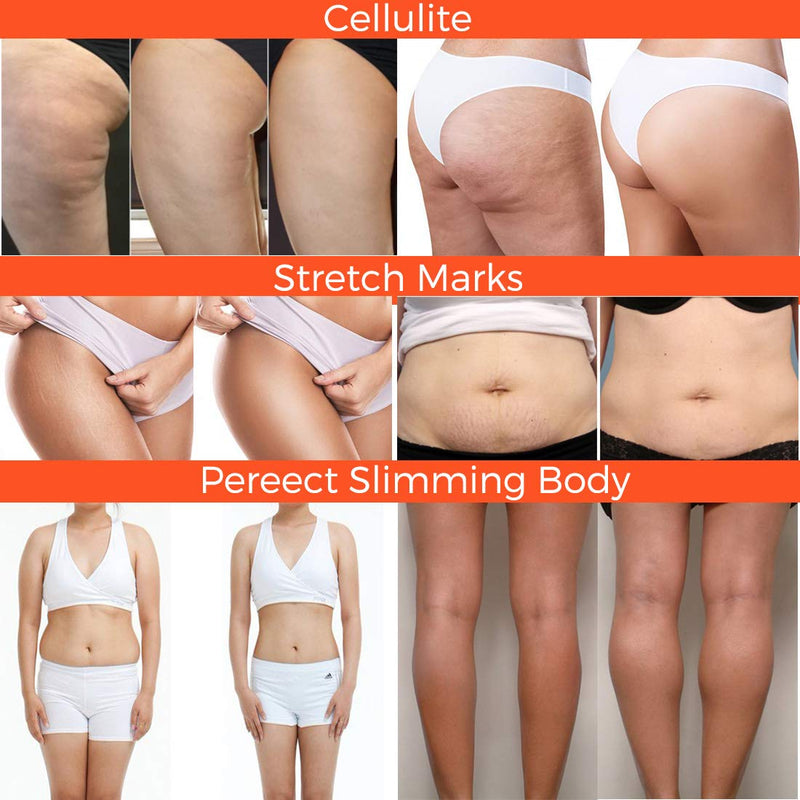 [Australia] - Hot Cream,Anti Cellulite Cream, Cellulite Remover, Anti Cellulite Treatment, Body Firming and Tightening Cream, Belly Fat Burner for Women and Men 