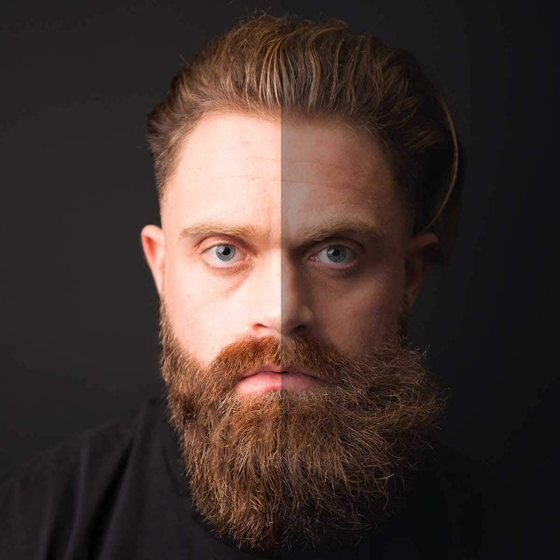 [Australia] - Beard Oil 100ml | Vanilla & Mango | Beard Care for Men | Softens, Hydrate & Conditions Facial Hair | Promotes Growth, Reduces Dryness & Itching | Contains Natural & Premium Ingredients Argan, Jojoba, Sweet Almond & Grapeseed Oil 