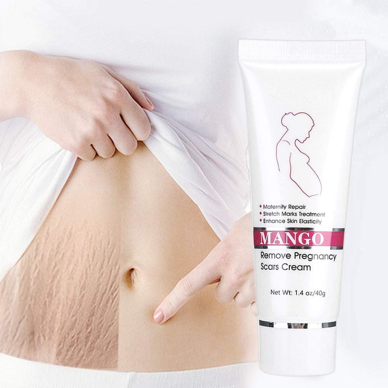 [Australia] - Anti-stretch marks postpartum to dilute stretch marks, repair abdominal moisturizing body cream, fat lines, eliminate obesity lines to tighten pregnant women's prevention products. Special skin care p 