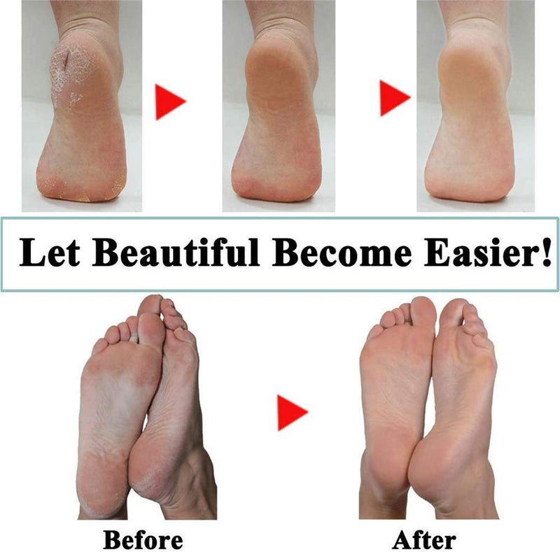 [Australia] - 5 Extra & 3 Regular & 2 Soft Coarse Refill Heads Replacement Rollers Compatible with Perfect Electronic Foot File with Diamond Crystals 