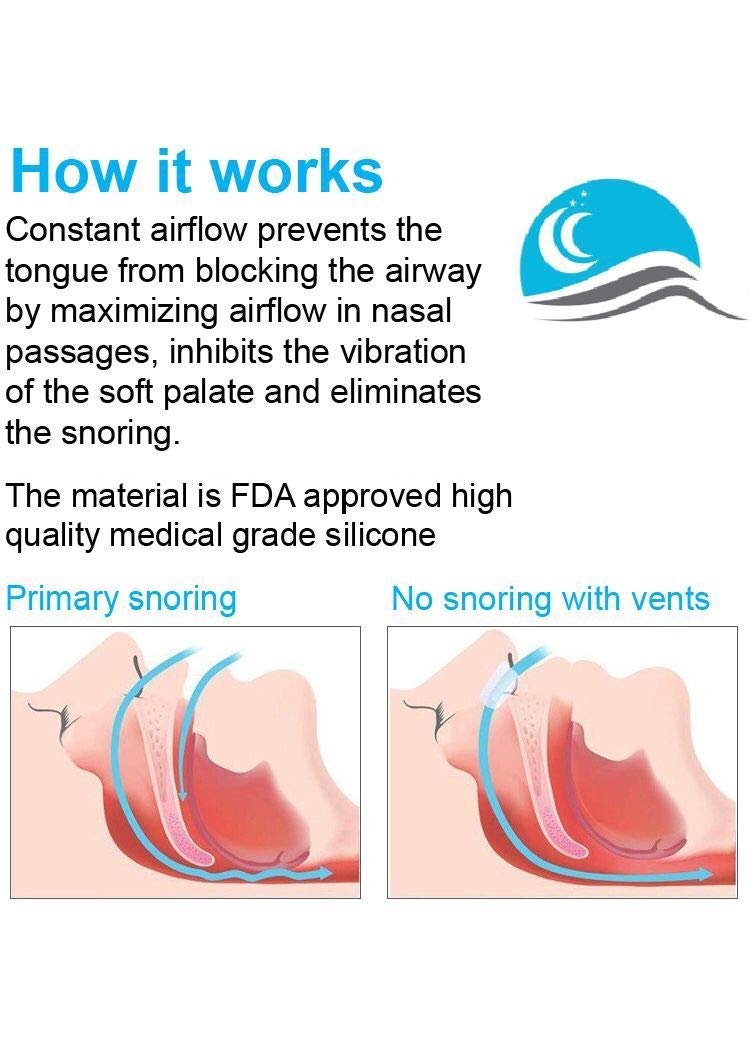 [Australia] - Anti Snoring Nose Vents by Snore Bastion -12 Nasal Cones - Nasal Dilator to Stop Snoring - Sinus Relief Cones - Medical Grade Silicone Snore Stopper - Easy to Use Snoring Solution 