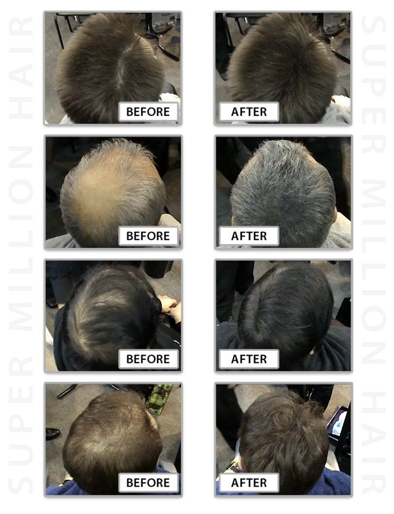[Australia] - Super Million Hair - 1 x 25g Hair Building Fibres - No.7 Wheat Blonde 