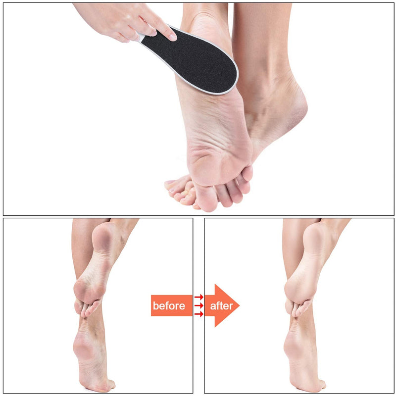 [Australia] - 4 Pieces Double-Sided Foot File Foot Rasp File Dead Skin Remover Foot Scrubber Hard Skin Remover Foot Care for Wet and Dry Cracked Feet 