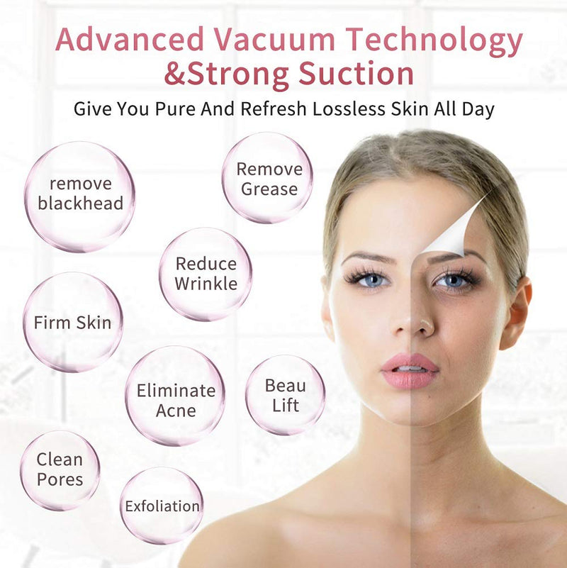 [Australia] - Blackhead Remover Vacuum (Pink) Pink 