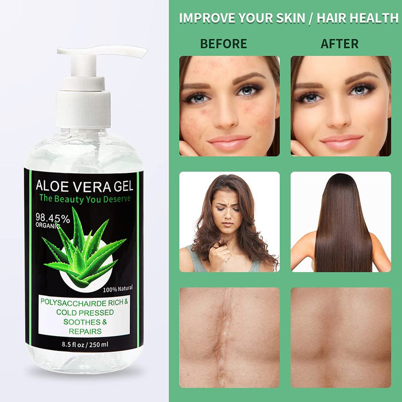 [Australia] - Ciencimy Aloe 98.45% Pure Moisturizing Organic Aloe Vera Gel for Body, Skin, Face, Hair, Daily Moisturizer, Aftershave Lotion, Sunburn Relief, Burn Care - 8.5 oz 