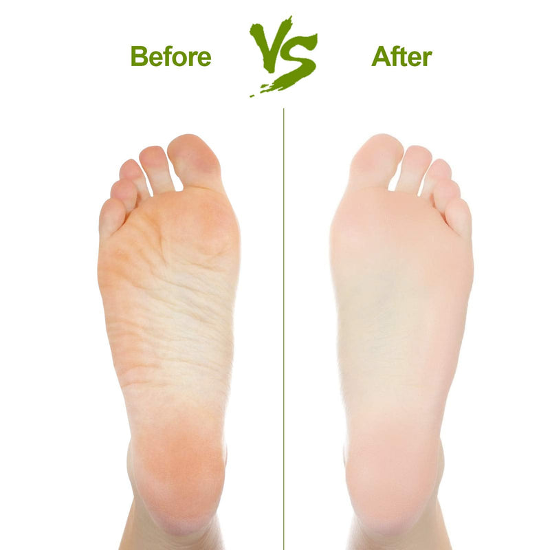 [Australia] - Natural Pumice Stone for Feet 2 PCS,Lava Pedicure Tools Hard Skin Callus Remover for Feet and Hands - Natural Foot File Exfoliation to Remove Dead Skin 