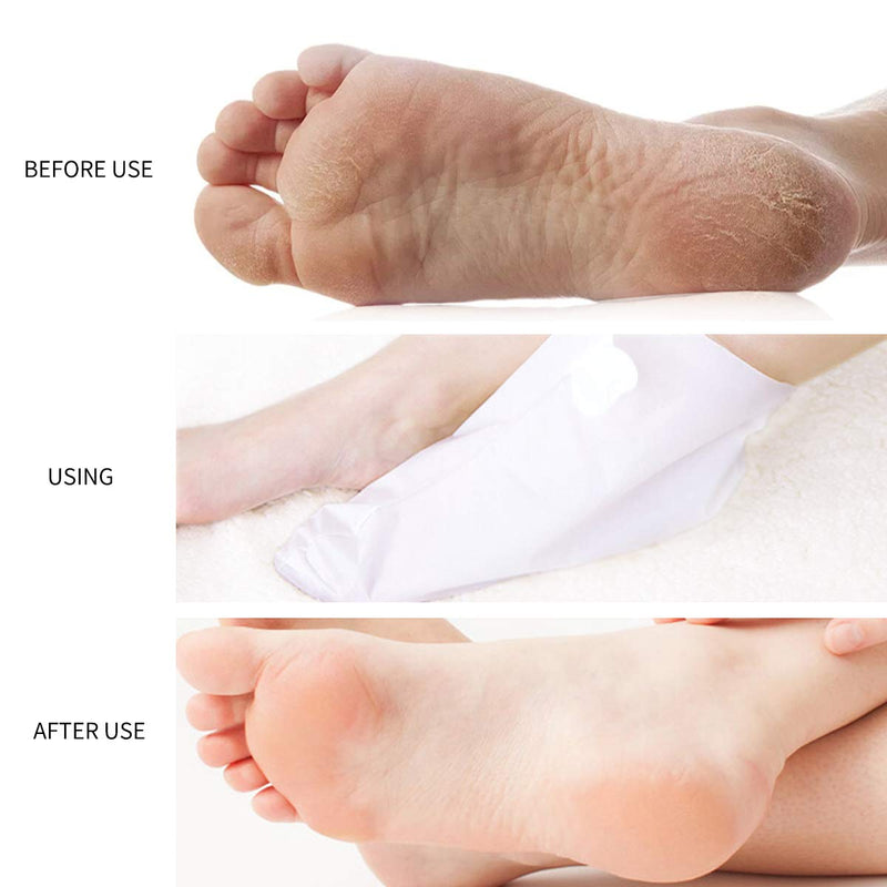 [Australia] - YOUPINWEI Moisturizing Foot Mask Treatment for Cracked Heels and Dry Feet Deeply Repair, Care for Long-lasting Hydrating & Nourishing Socks for Smoother and Softer Feet (5Pairs/Box) 