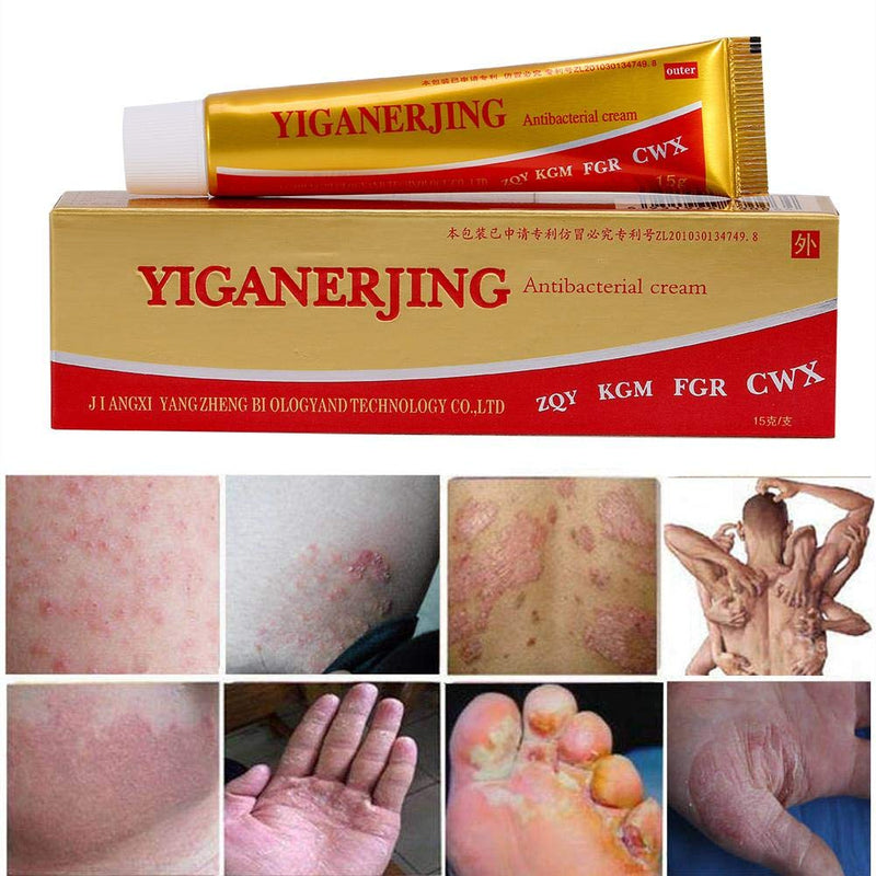 [Australia] - Advanced Psoriasis Treatment Cream Moisturizer, Natural Eczema Treatment Psoriasis Cream Chinese Medicine Cream for Skin Disease 