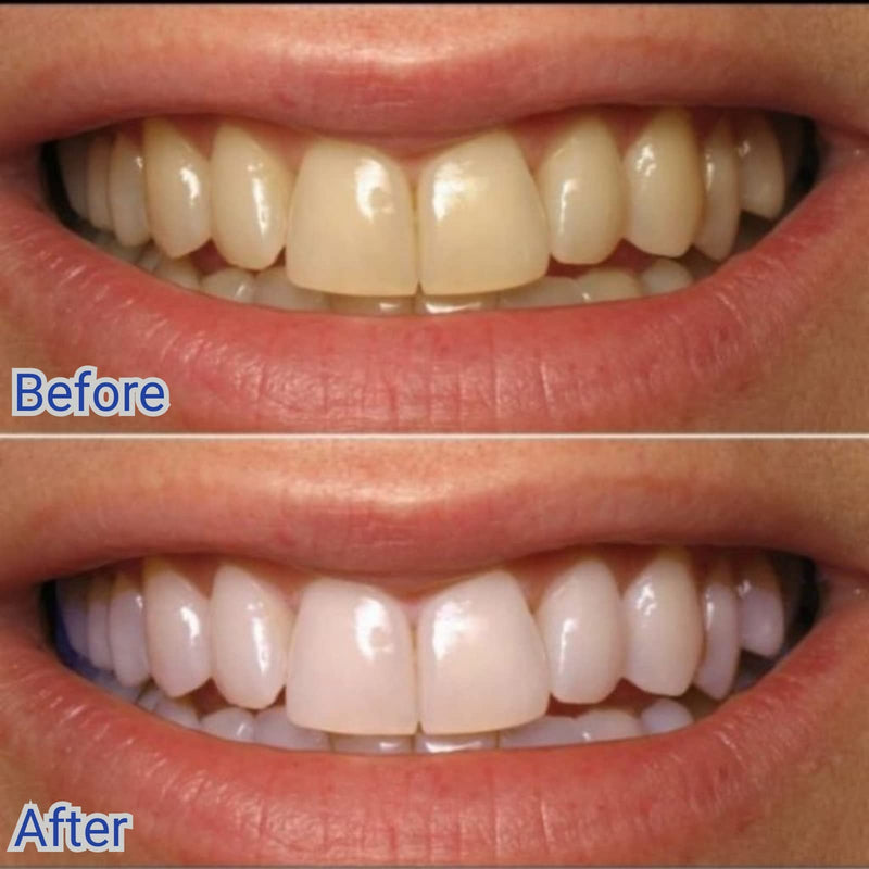 [Australia] - Eucryl Stain Removal Toothpowder Original 50g 