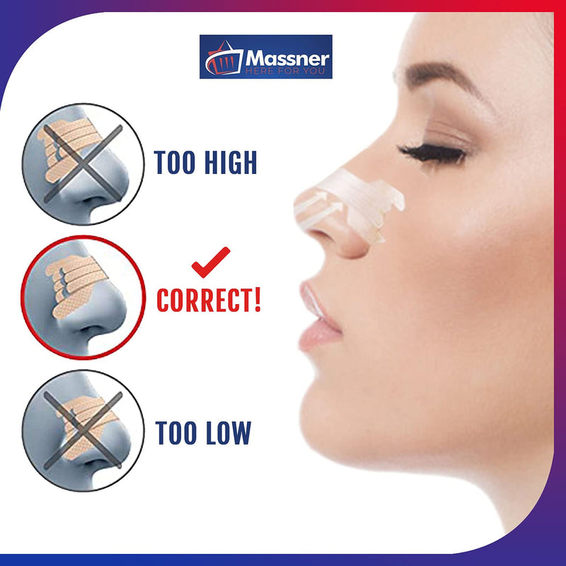 [Australia] - 100 Medium Nasal Strips Anti-Snoring Aid for Fast Relief. Instantly Stops Snoring for Better Sleep, Less Congestion. Improved Air Flow, Gentle Spring Like Action. 55x16mm, Big 3 Month Supply 