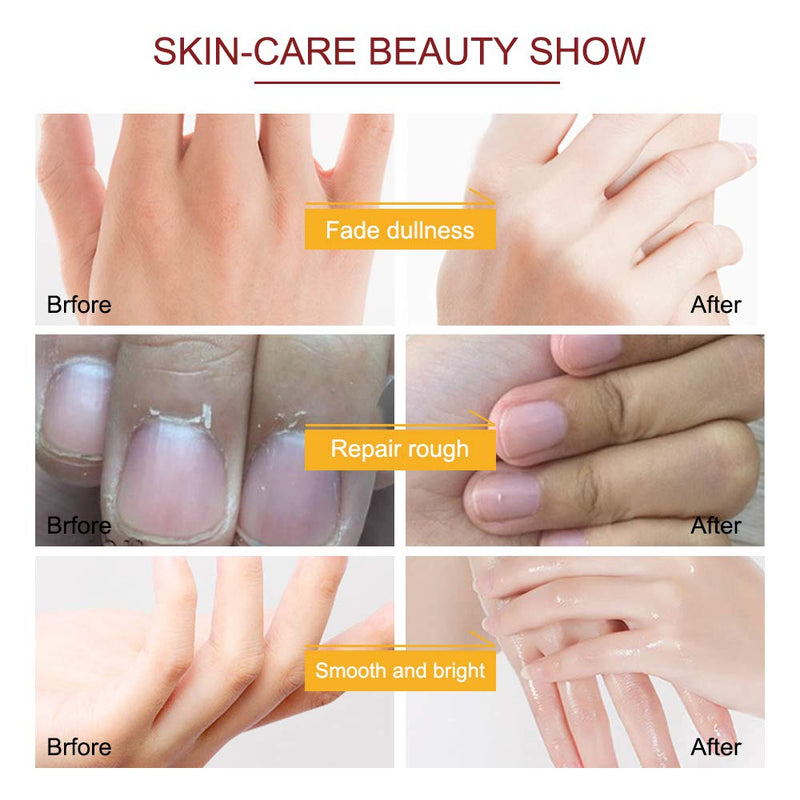 [Australia] - Hand Moisturizing Mask, (5 Pack) Honey and Milk Gloves, Moisturizing Natural Therapy Gloves, for Dry Aging Cracked Hands Repair Rough Skin for Men Women honey mask 