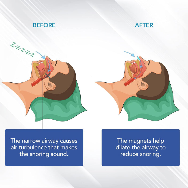 [Australia] - Skyloa Anti Snoring Devices - Silicone Magnetic Anti Snoring Nose Clip, Snore Stopper, Provide Effective Snoring Solution - Comfortable Nasal to Stop Snoring(4 PCS) 