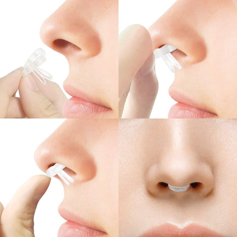 [Australia] - WoodyKnows Super-Support Nasal Dilators (Combo S+M+L 3 Pack) Combo S M L 3 Pack 