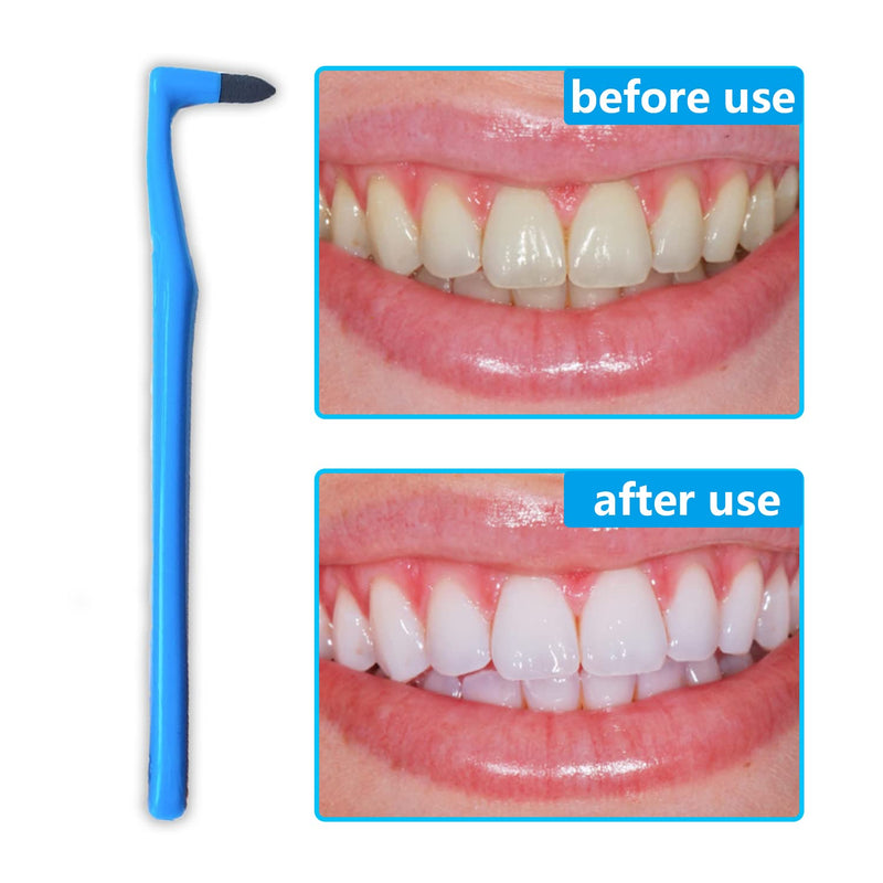 [Australia] - NITAIUN 5 Pieces Remover Tooth Cleaning kit, Teeth Stain Eraser Teeth Polishing Cleaning Kit Whitening Cleaning Eraser Oral Hygiene Care Tool 
