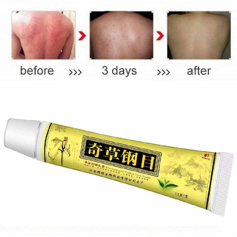 [Australia] - 2pcs/Lot Chinese Herbal Eczema, Psoriasis Creams Dermatitis and Eczema Pruritus Psoriasis Ointment 