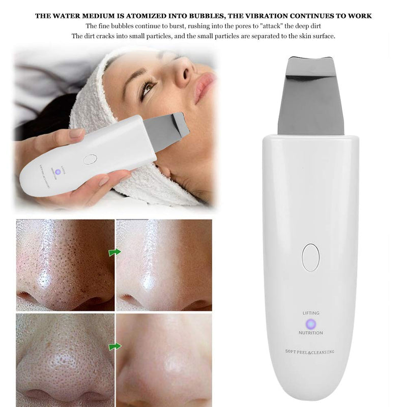 [Australia] - Face Scraper Massager, Ultrasonic Skin Scrubber Spatula Blackhead Remove Tool Exfoliator Comedone Extractor Facial Pore Cleanser for Exfoliation and Facial Firming(white) white 