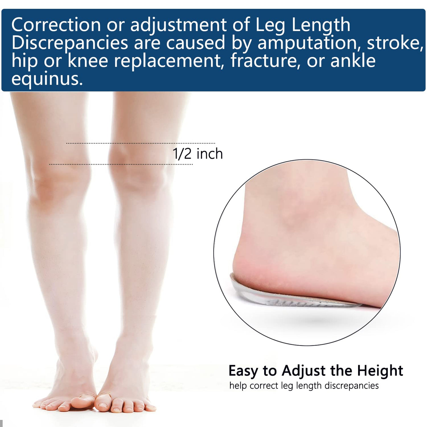 1 Inch Gel Shoe Lifts Women Uneven Legs Adjustable Orthopedic Heel Lifts  Heel | eBay