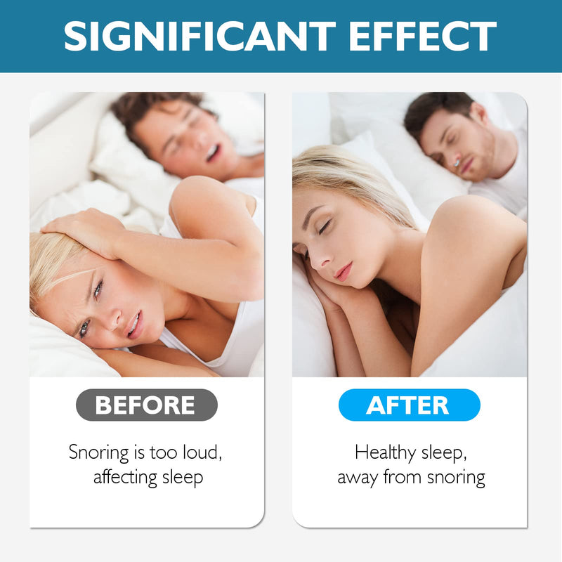 [Australia] - Snore Stopper, Anti Snoring Devices, 4 PCS Magnetic Anti Snoring Nose Clip Provide The Effective Snoring Solution to Stop Snoring 4 Count (Pack of 1) 