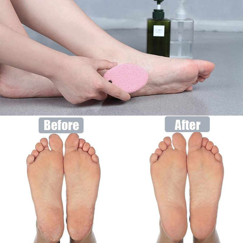 [Australia] - Pumice Stone 2 Pcs for Women, Multi-Colored Pumice Stone for Feet/Hand, Hard Skin Callus Remover/Foot Scrubber Stone by MAYKI 