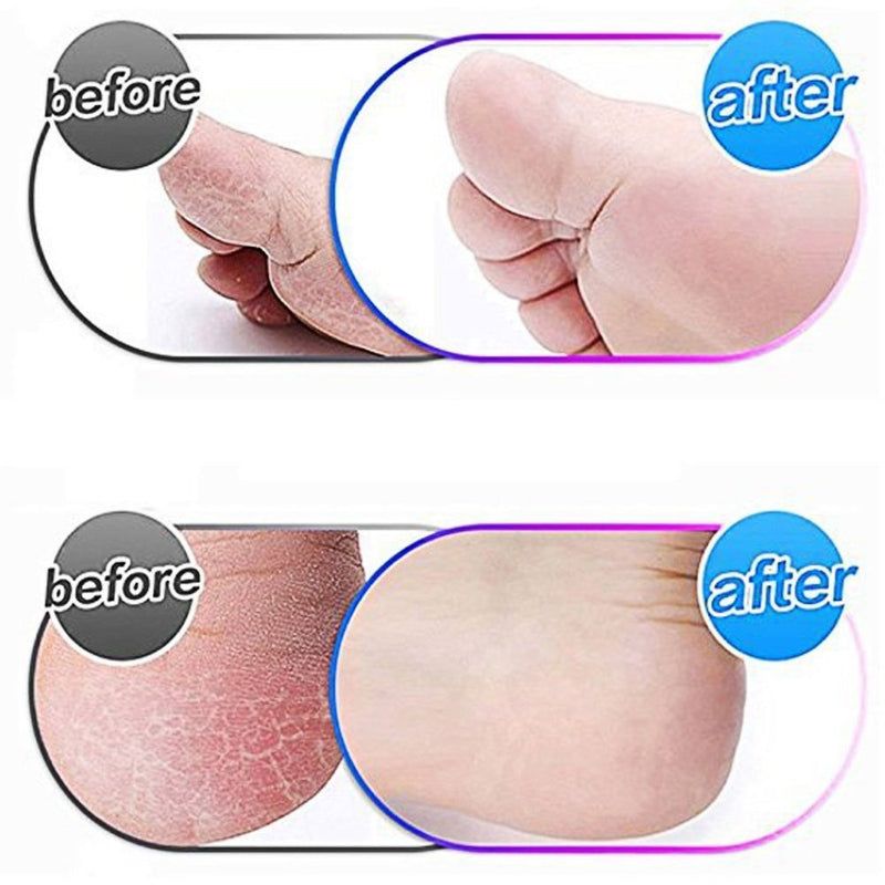 [Australia] - 8 Pack Replacement Roller Refills Compatible with Scholl Express Pedi Foot Smoother-Extra Coarse 8 Pack 