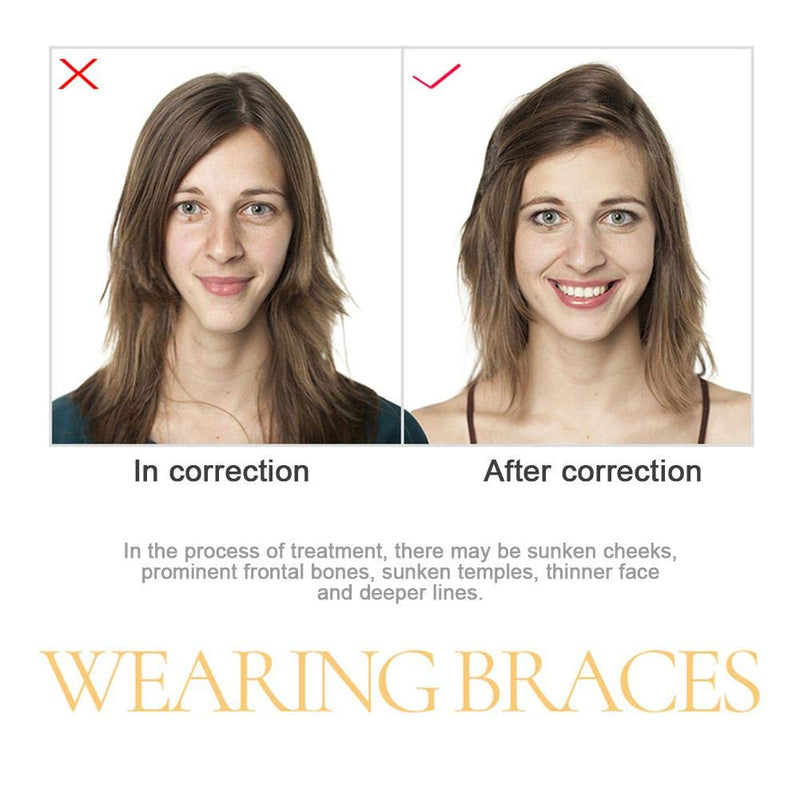 [Australia] - Silicone Orthodontic Chewies for Aligner Trays Chewies for Aligner Trays invisalign chewies for Oral Care Dental Mouth Health 2 Piece 