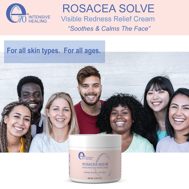 [Australia] - E70 Rosacea Solve - Redness Relief Cream - Calming Face Moisturizer For Rosacea and Acne-Prone Skin - Sensitive Skin Care With Organic Ingredients such as Aloe Vera, Almond Oil, Licorice and Chamomile Extracts - No Parabens 