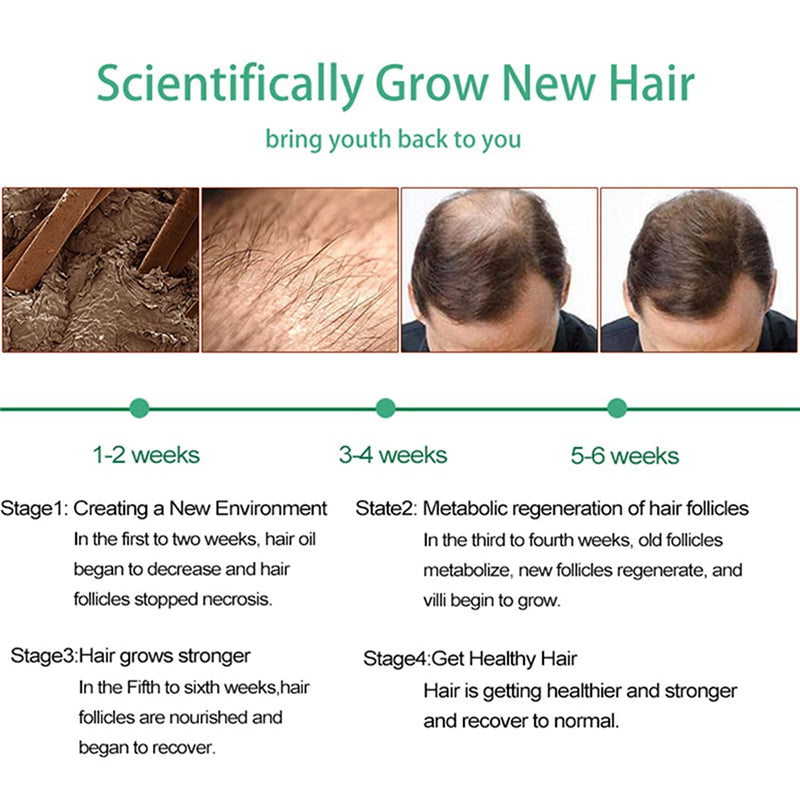 [Australia] - Hair Growth Serum, Hair Care Product, Hair Serum, Fast Hair Growth, Hair Growth & Hair Thickening,Stop Hair Loss, Grow Hair Fast, Hair Loss Treatment for Men & Women(30ml) 