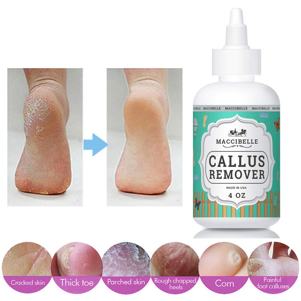 Yokita Professional Callus Remover Gel for Feet Extra  Strength, For Rough Calluses (1 Bottle) (4 ounce) : Health & Household