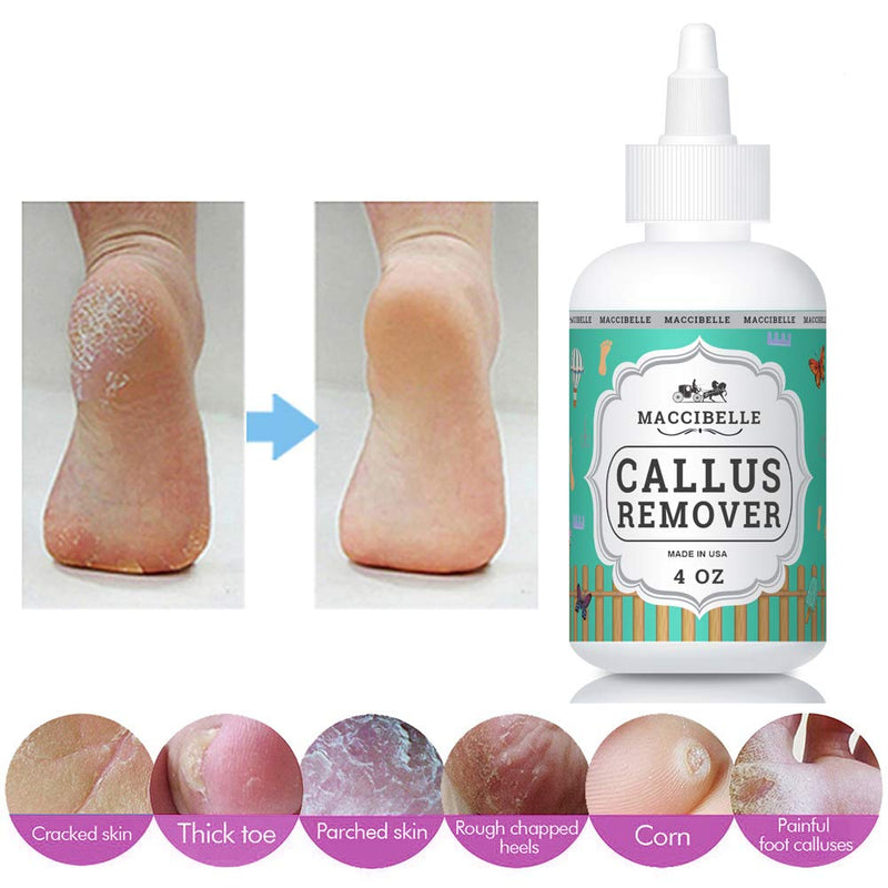 [Australia] - Maccibelle Callus Remover EXTRA STRENGTH For Feet, Professional Callus and Corn Eliminator Liquid Gel 4 oz Pack of 1 