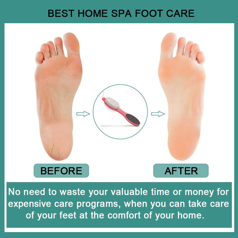 [Australia] - CAREHOOD Foot File Callus Remover - Multi Purpose 4 in 1 Feet Pedicure Tools with Foot Scrubber, Pumice Stone, Foot Rasp and Sand Paper for Home Foot Care (Red Pedicure Foot File) Red Pedicure foot file 