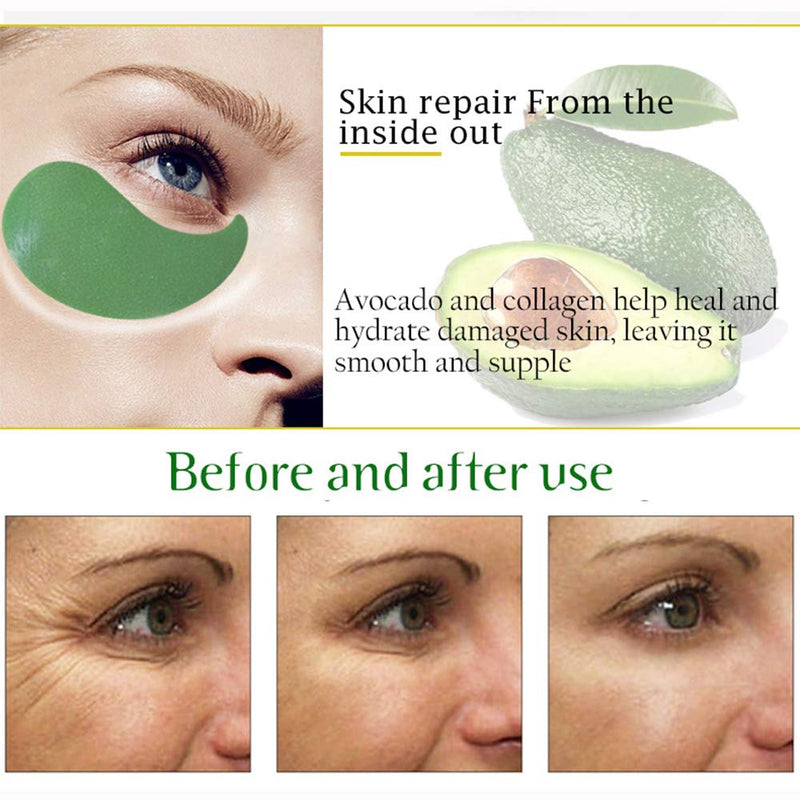 [Australia] - AICHUN BEAUTY 30 Pair Collagen Eye Mask Patch Hydro Gel Pad Anti-Wrinkle Dark Circles Bags Soft Smooth Skin Care Hydration Moisturizing (AVOCADO) Avocado 