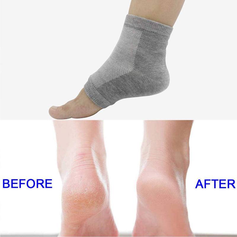 [Australia] - Yeeseok Moisturizing Gel Heel Socks, 4 Pairs Moisturizing Socks for Cracked Feet Women and Men Cracked Heels Silicone Pedicure Toeless Socks Used While Sleeping (2 Pairs Black & 2 Pairs Grey) 