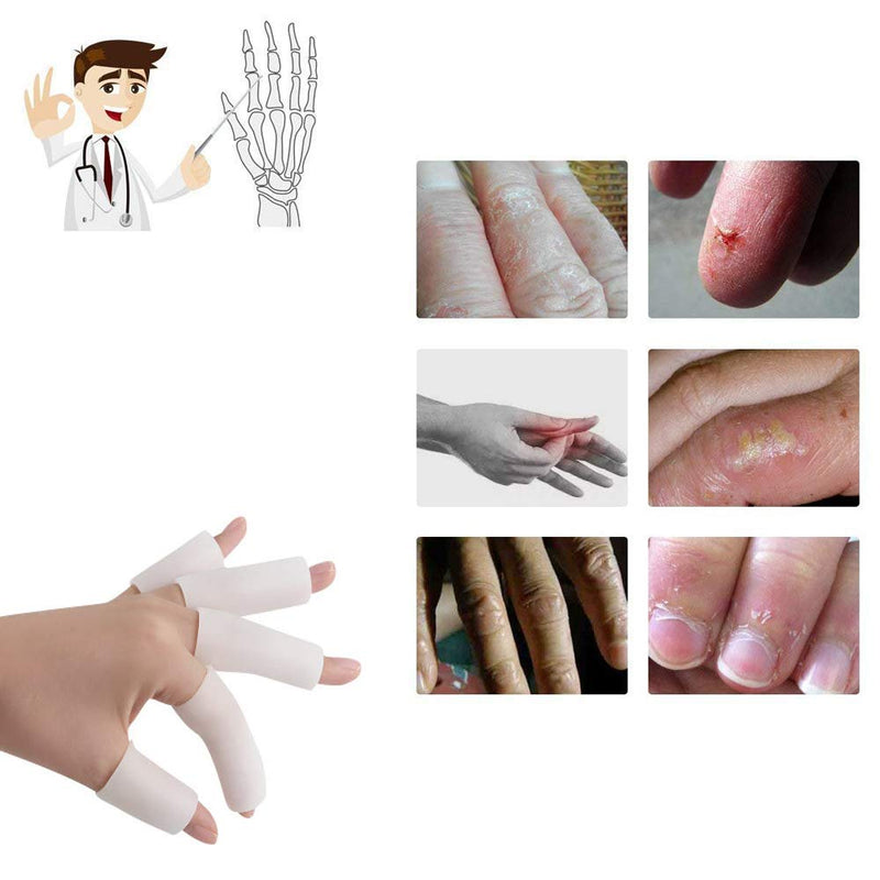 [Australia] - Gel Finger Cover, Silicone Finger Cots, Finger Protector for Women and Men, Great for Trigger Finger, Finger Cracking, Finger Arthritis, Finger Callus(10 pcs, White) 