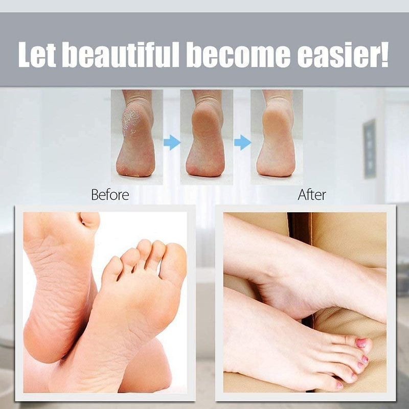 [Australia] - 100 PACK Foot File Refills, Sand papers Replacement Pedicure File Refill,Abrasive Pedicure File Replacement Pads,Black Pack for Double Sided Foot Rasp File 