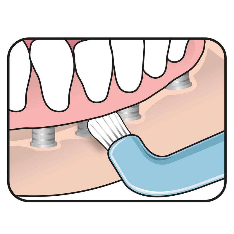 [Australia] - TEPE Compact Single Tuft Brush for Precision Cleaning of Difficult Areas, Such as Braces, Gum line and implants - 1 x TEPE Compact Brush (Pack of 2) 1 count (Pack of 2) 