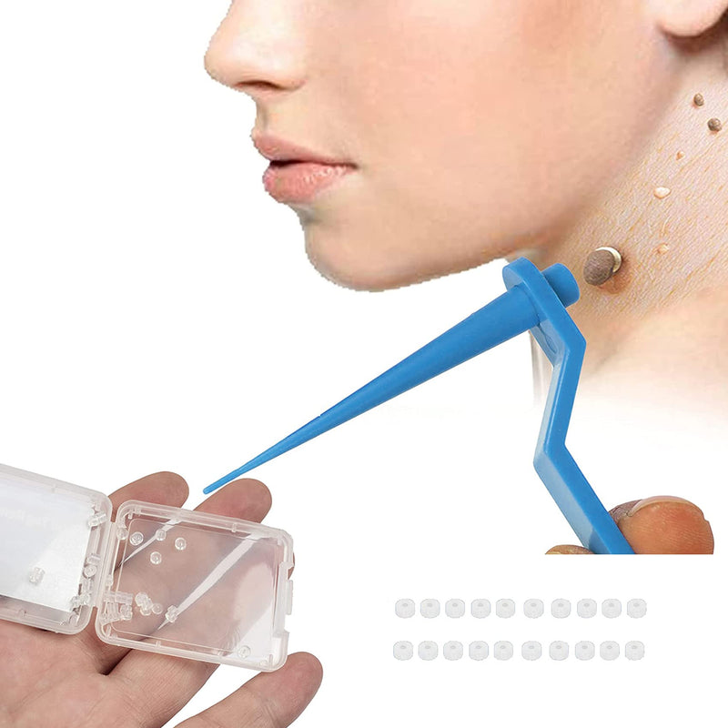 [Australia] - Rpanle Skin Tag Remover, Skin Tag Removal Kit with 20 Skin Tag Bands, Painless and Safe Remove Small to Large Sized (2mm to 4mm) Skin Tag 
