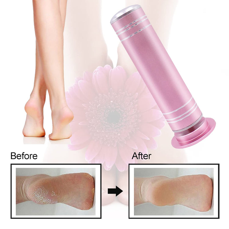 [Australia] - Busdeals Electric Foot Callus Remover(Speed Adjustable) with 60pcs Replaceable Sandpaper Discs, Electronic Foot File Pedicure Foot Sander for Dead Skin Removal(Pink) 