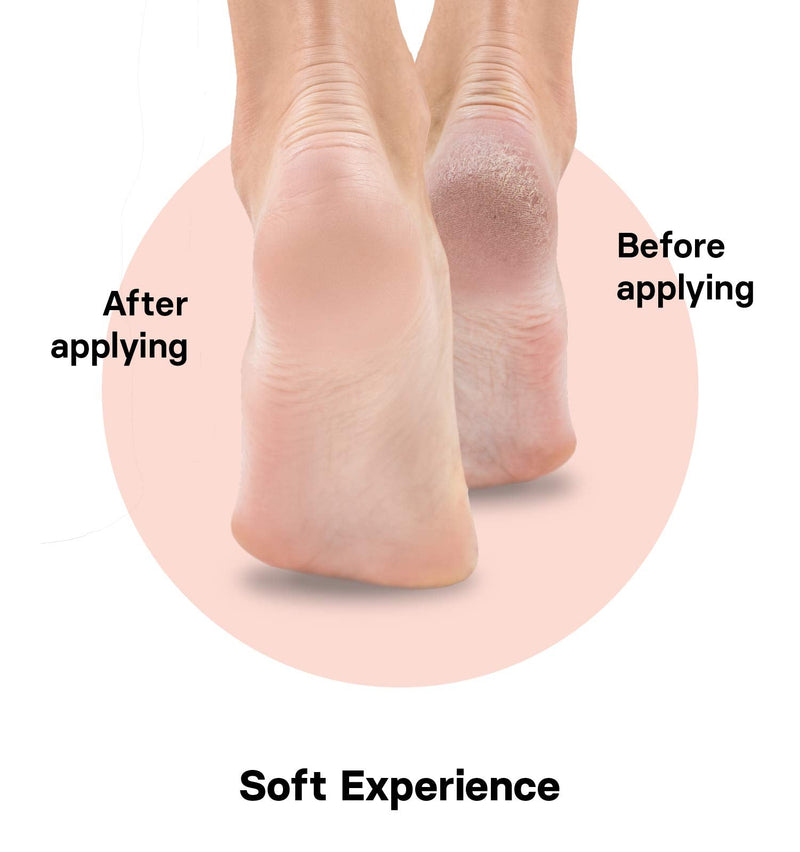 [Australia] - VALNEO Foot Scrubber - Callus and Dead Skin Remover for Feet - Coarse and Fine Foot Rasp File for Pedicure Tools - Heel Scraper Exfoliator - Rubber Wood Grater for Wart Removal 