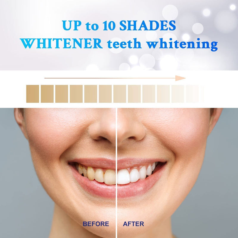 [Australia] - Waving Palms Teeth Whitening Strips, Whitening Strips, 28 Non-Sensitive Whitening Strips, Teeth Whitening Kit, 14 Sets Fast-Result Teeth Whitener, Peroxide Free Teeth Whitening Strips 