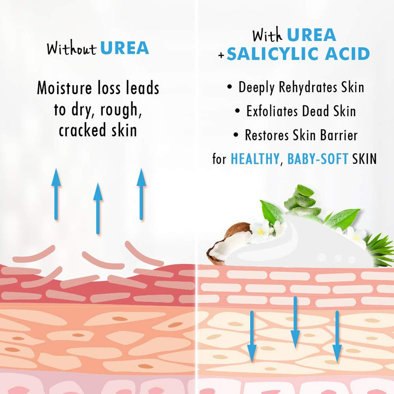 [Australia] - Urea Cream 40% Plus Salicylic Acid 4.6 Oz, Callus Remover Hand Cream Foot Cream For Dry Cracked Feet, Hands, Heels, Elbows, Nails, Knees, Intensive Moisturizes & Softens Skin, Exfoliates Dead Skin 4.6 Ounce (Pack of 1) 