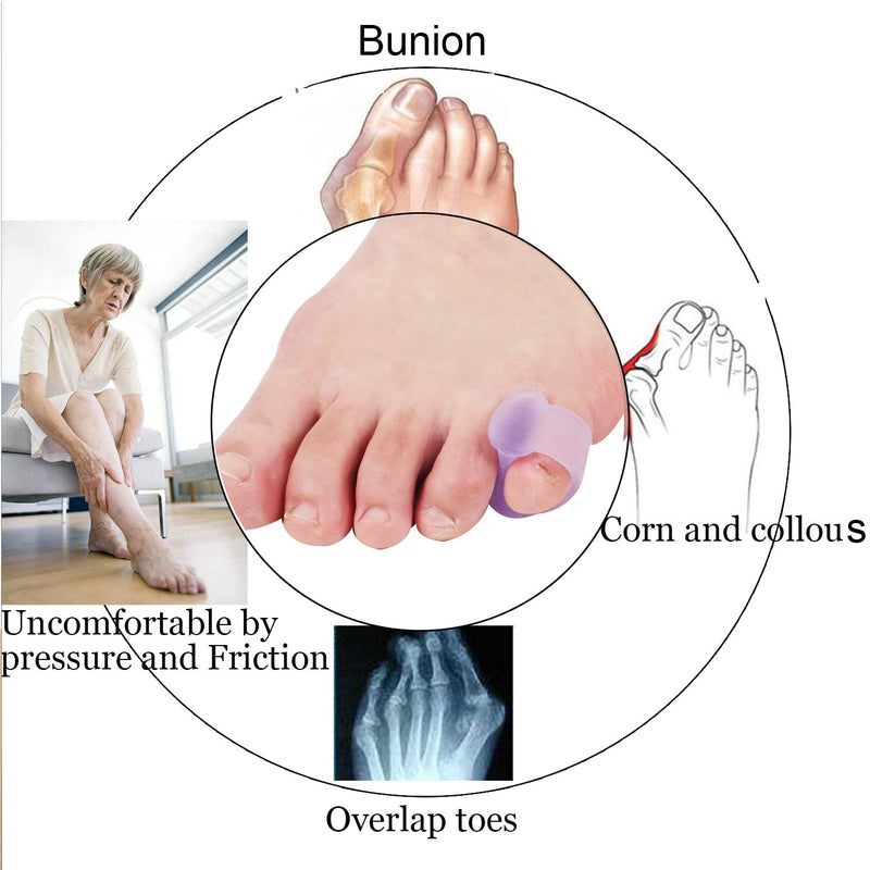 [Australia] - Yimanduo 10 Pcs Pinky Toe Splint, Gel Toe Separators, Little Toe Straightener Hammer Toe for Men Women Walking, Running, Overlapping, Bunion Corrector and Bunion Relief, Small 