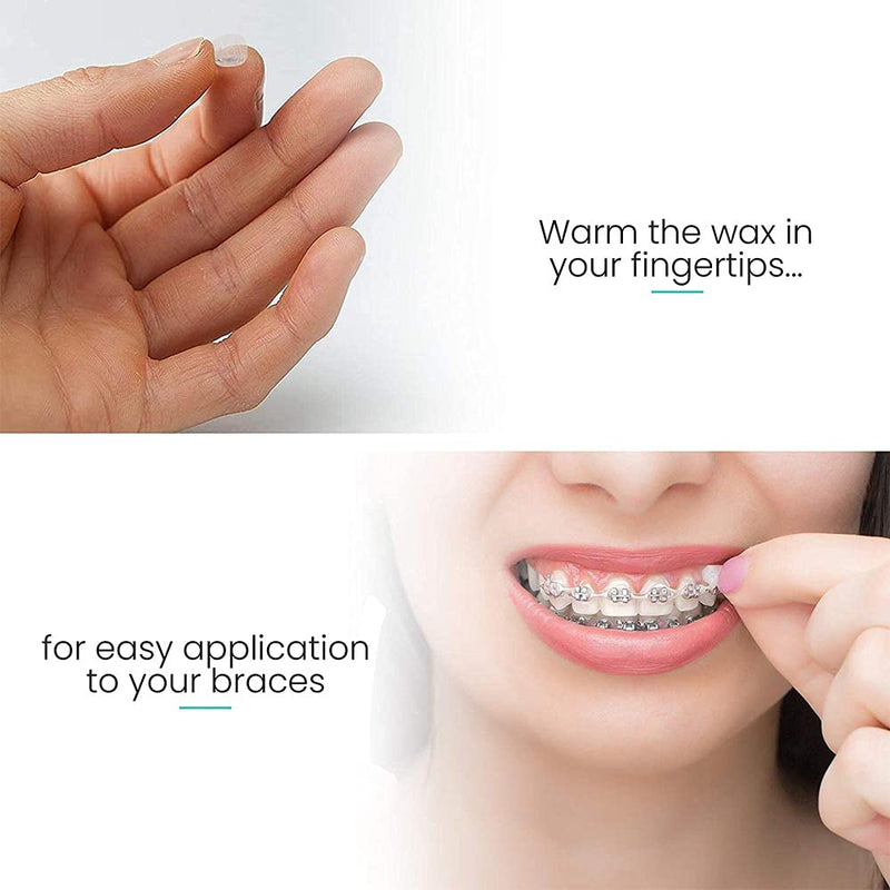 [Australia] - Dental Wax for Braces,Orthodontic Wax for Braces(Mint 1Box for 50Times) 1 