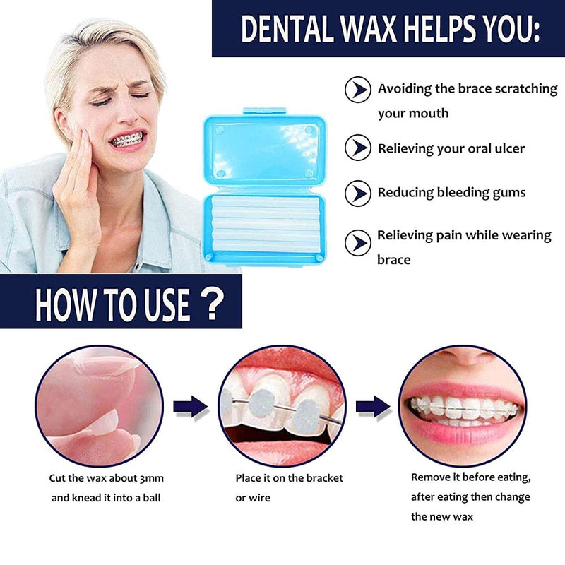 [Australia] - Dental Wax for Braces,Orthodontic Wax for Braces(Mint 1Box for 50Times) 1 