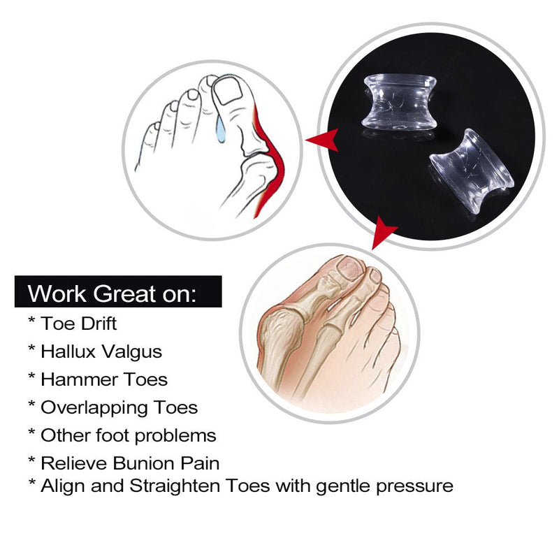 [Australia] - Sumiwish Toe Spacers and Separators, 10 Pack Bunion Corrector, Silicone Toe Separators for Overlapping Toe, Bunion Correct and Pain Relief Clear 