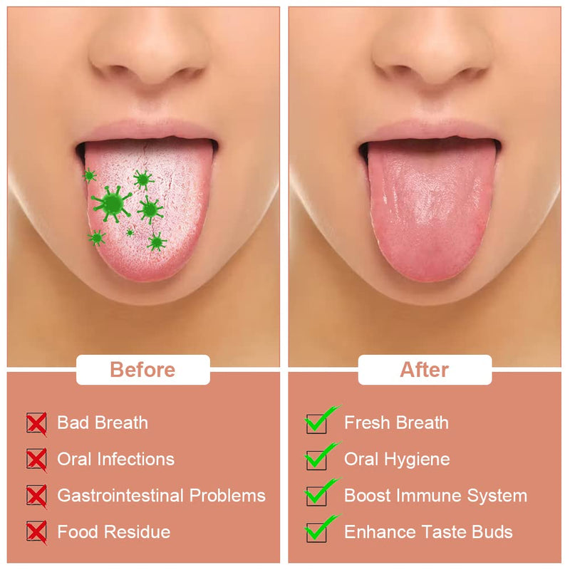 [Australia] - ACWOO Tongue Scraper, 2 Pack Stainless Steel Tongue Cleaners, Tongue Cleaner Tool for Oral Hygiene, Fresh Breath, and Reduce Bad Breath, Reusable Tongue Scrapers for Adults Silver 