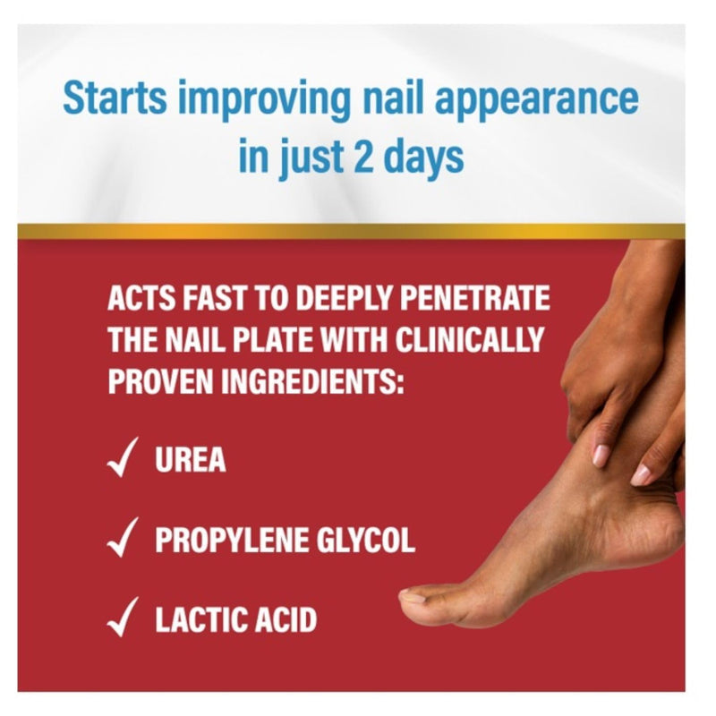 [Australia] - Kerasal Fungal Nail Renewal Treatment 10ml, Restores The Healthy Appearance of Nails Discolored or Damaged by Nail Fungus or Psoriasis. 