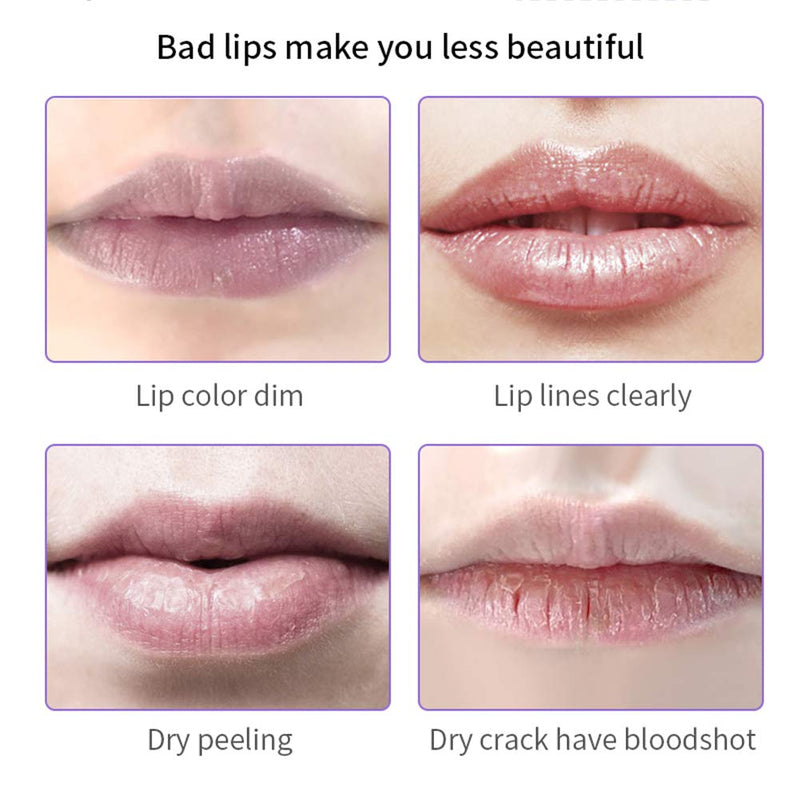 [Australia] - Honey Lip Mask, Lip Masks for Dry Lips, Day and Night Repair The Lip Color Fade Lip Lines Hydrating Prevention Dry and Crack Lipstick Raincoat, Sleeping Lip Mask (honey for day use) honey for day use 